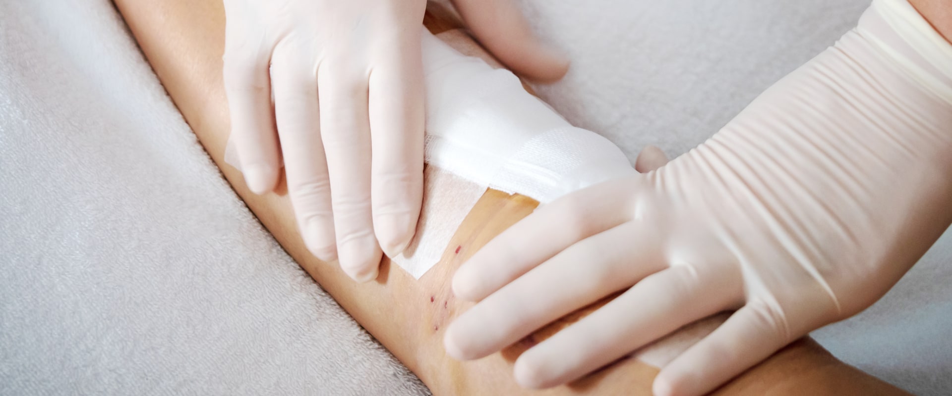 Types Of Wound Dressing And Their Role In Effective Wound Management Strategies