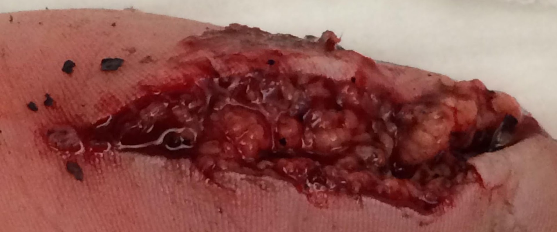 8 Key Principles for Effective Wound Management