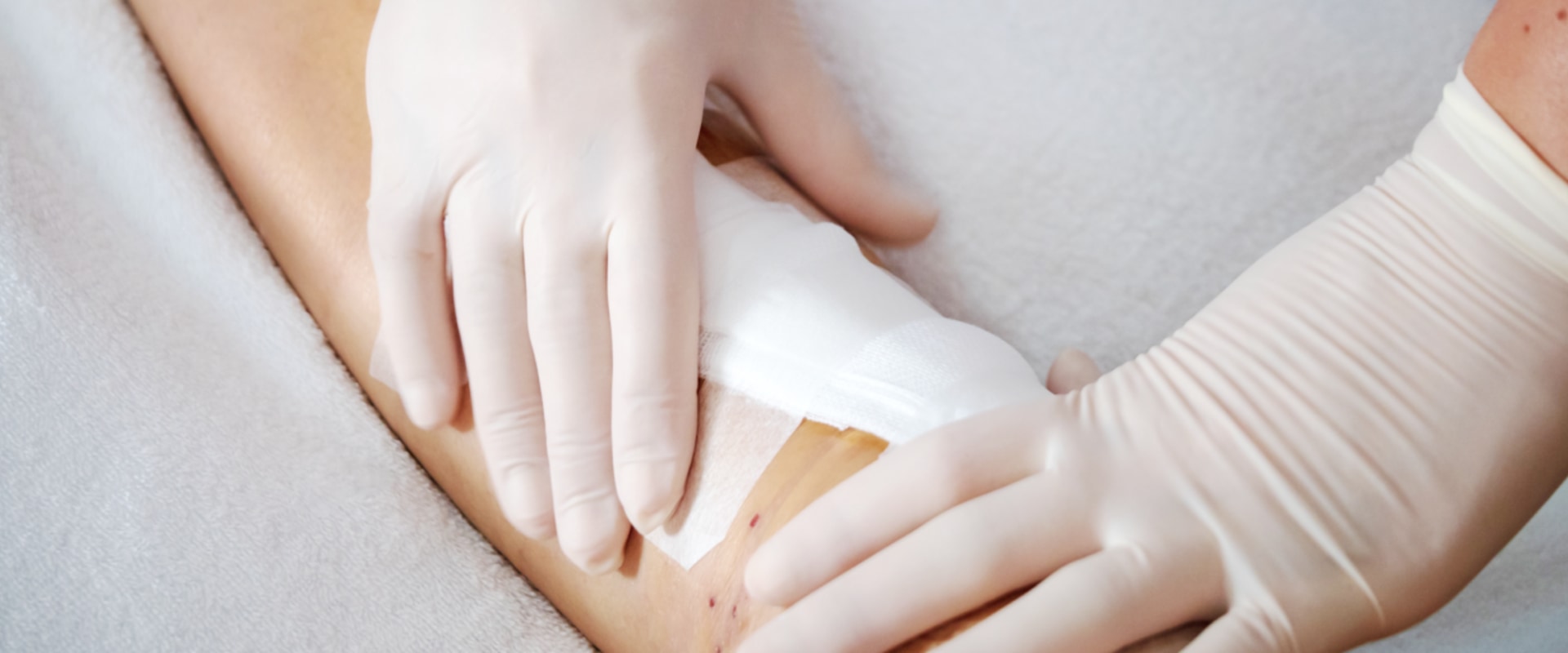 What Is Gauze Wound Dressing Used For? Exploring Its Effectiveness In Top Wound Management Strategies