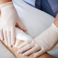 Types Of Wound Dressing And Their Role In Effective Wound Management Strategies