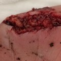 8 Key Principles for Effective Wound Management