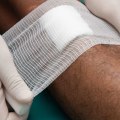 The Importance of Proper Wound Care: A Comprehensive Guide