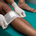 The Importance of Properly Covering Wounds for Optimal Healing