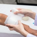 Advanced Care Strategies For Denuded Skin Wounds