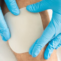 The 5 Essential Elements of Wound Care: A Comprehensive Guide