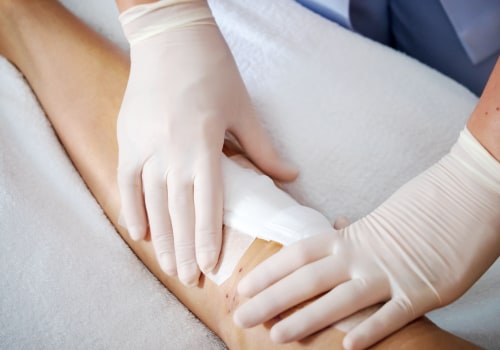 Types Of Wound Dressing And Their Role In Effective Wound Management Strategies