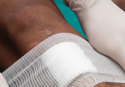 The Importance of Proper Wound Care: A Comprehensive Guide