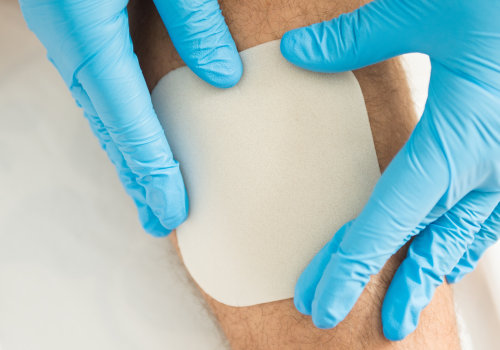 The Five Essential Principles of Wound Healing: A Comprehensive Guide for Healthcare Professionals