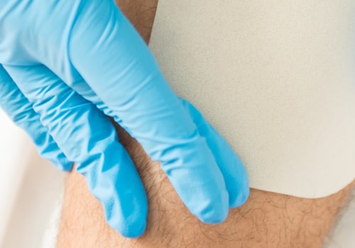 The 5 Key Elements of Individualized Wound Management